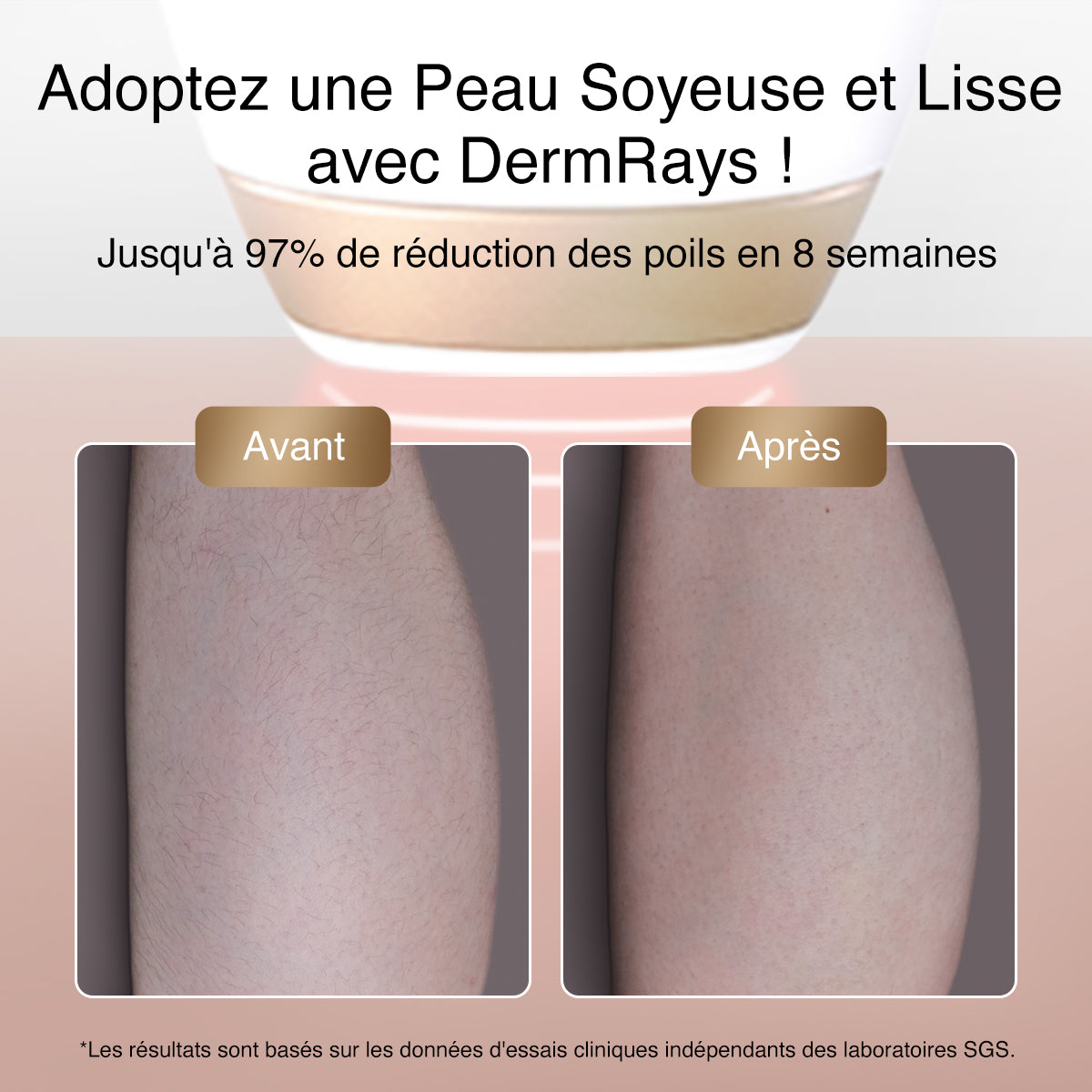 DermRays V4S laser hair removal, 810 nm, up to 21 days