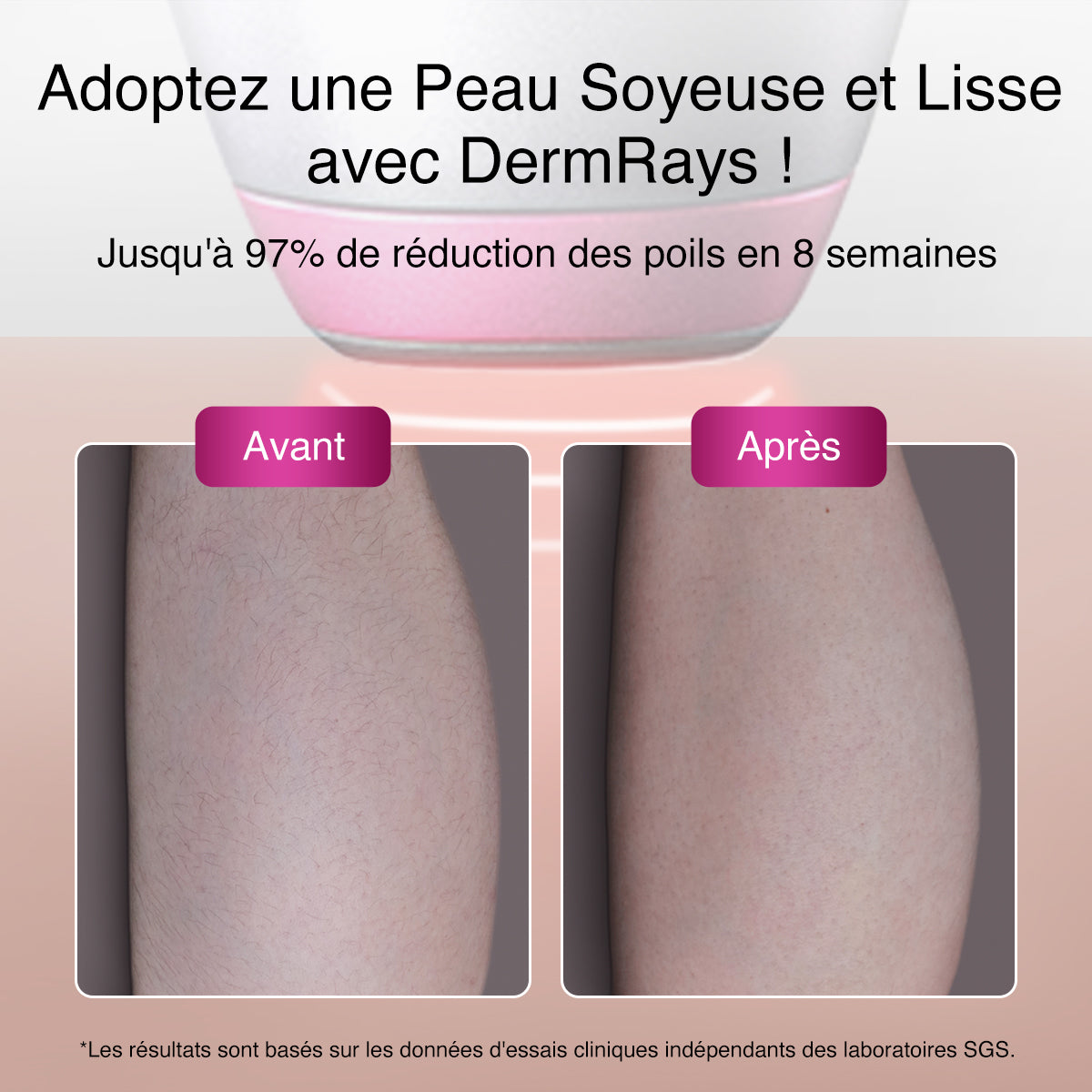 Épilation au laser DermRays V6S, 1064 nm, spécifiquement pour les peaux profondes