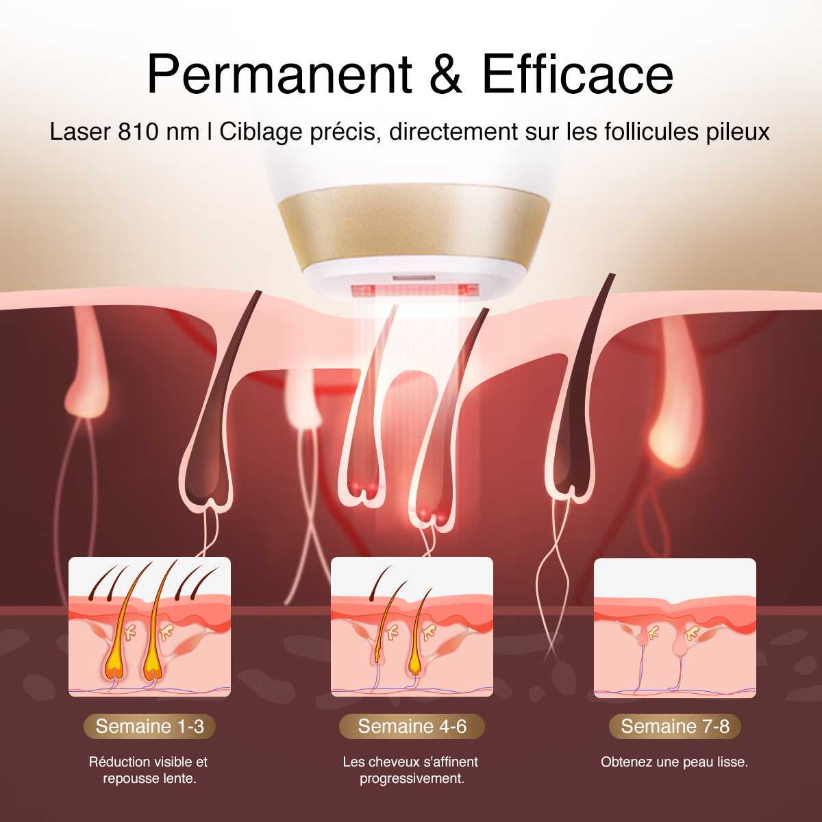 Épilation laser DermRays V4S, 810 nm, jusqu'à 21J