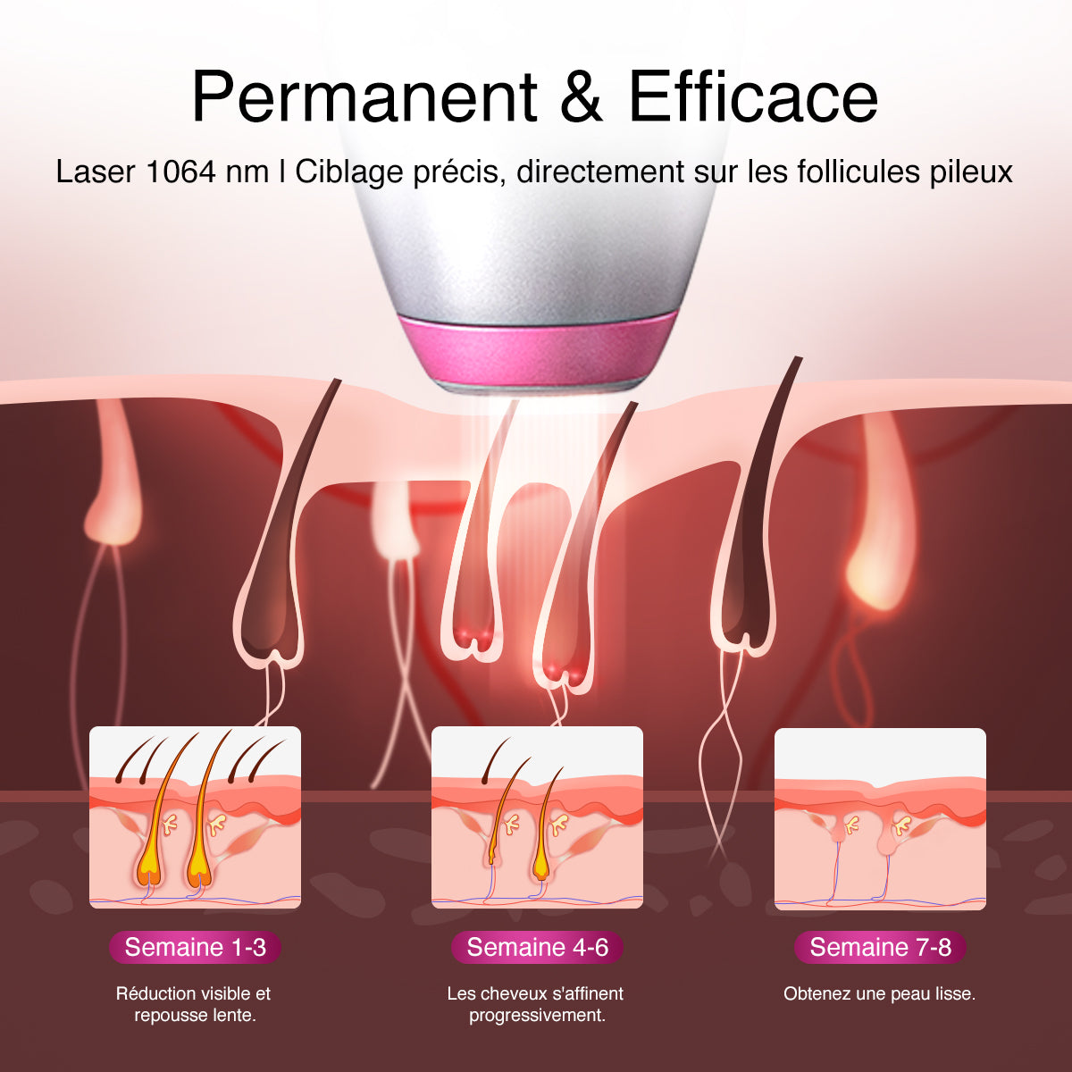 Épilation au laser DermRays V6S, 1064 nm, spécifiquement pour les peaux profondes