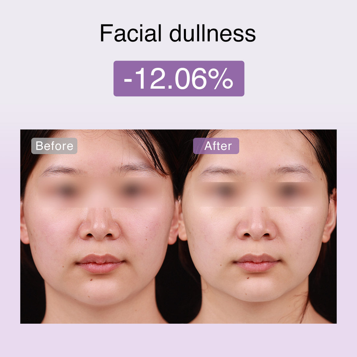 DermRays FusionGlow Appareil de Toning Facial Microcourant Multifonction