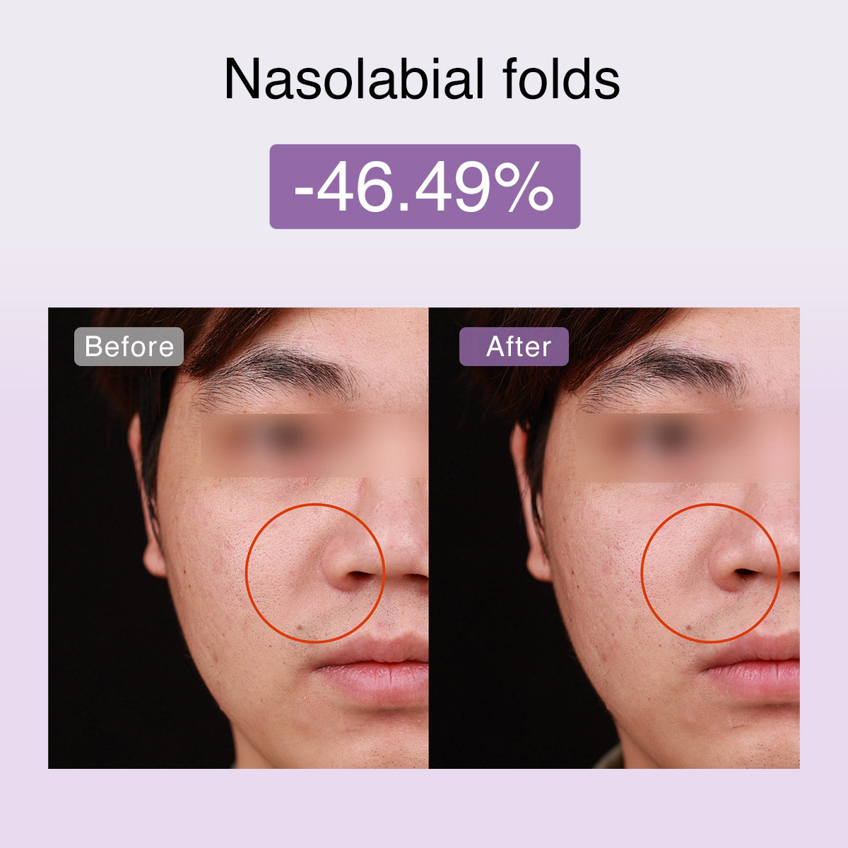 DermRays FusionGlow Appareil de Toning Facial Microcourant Multifonction