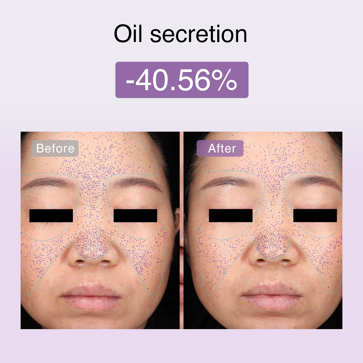 DermRays FusionGlow Appareil de Toning Facial Microcourant Multifonction