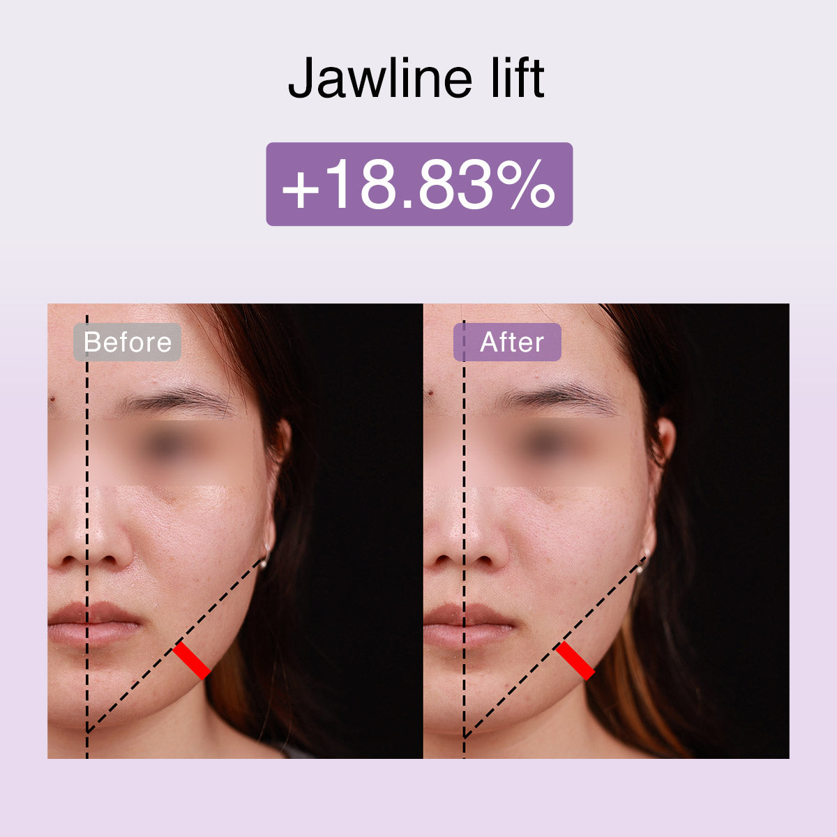 DermRays FusionGlow Appareil de Toning Facial Microcourant Multifonction